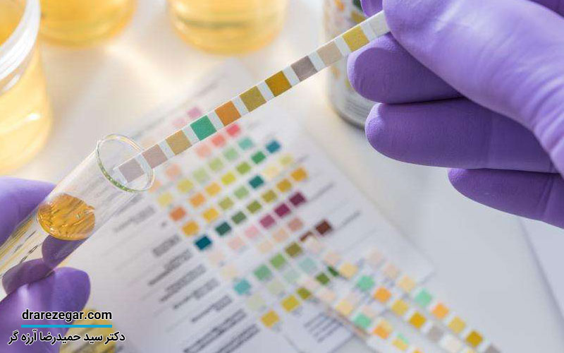 انواع عفونت کلیه و مجاری ادراری در آقایان و بانوان