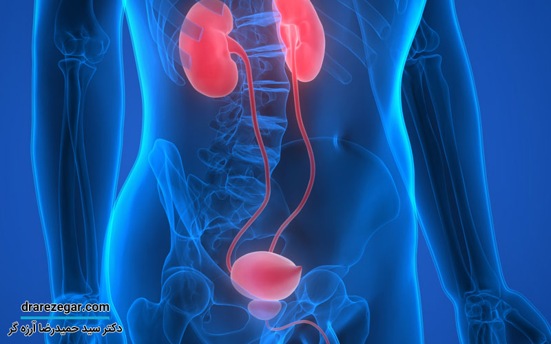 انواع عفونت کلیه و مجاری ادراری در آقایان و بانوان