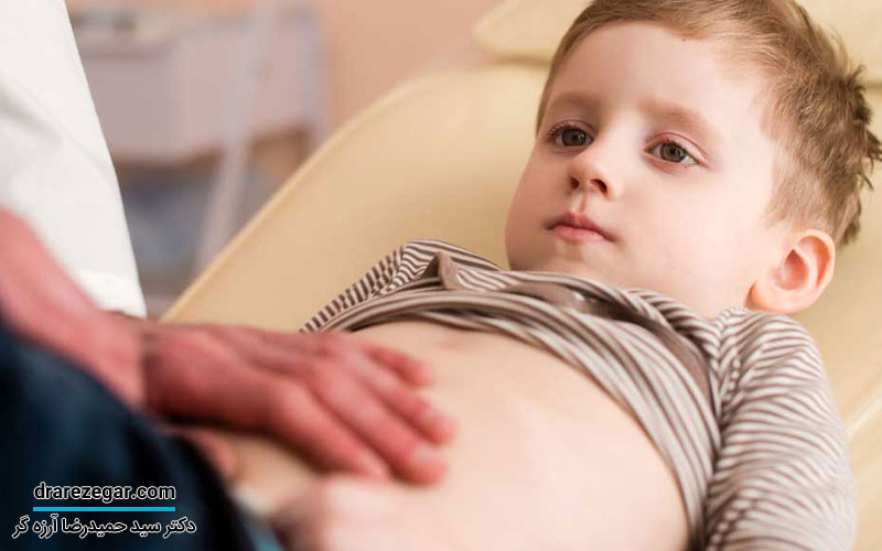 عمل جراحی هیدروسل در نوزادان پسر