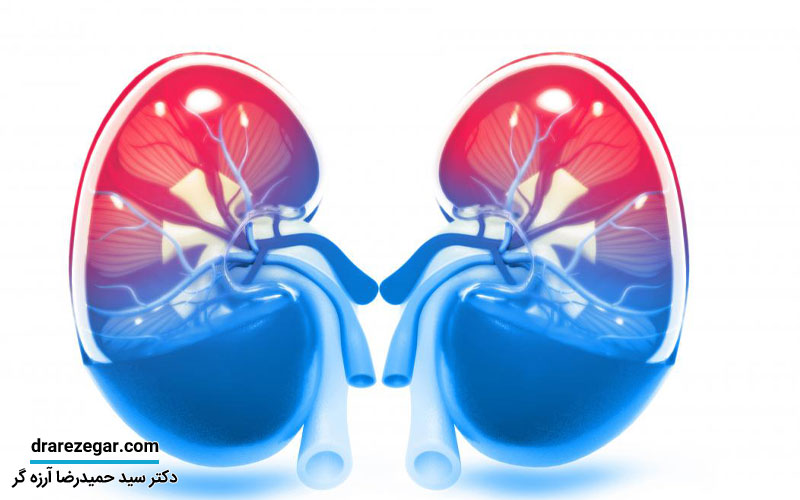 5 گام موثر برای حفظ سلامت همیشگی کلیه ها