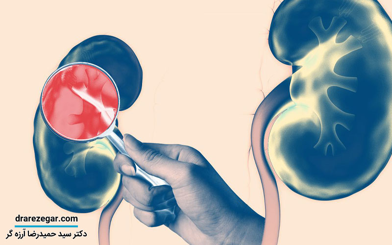 جراحی برداشتن کلیه