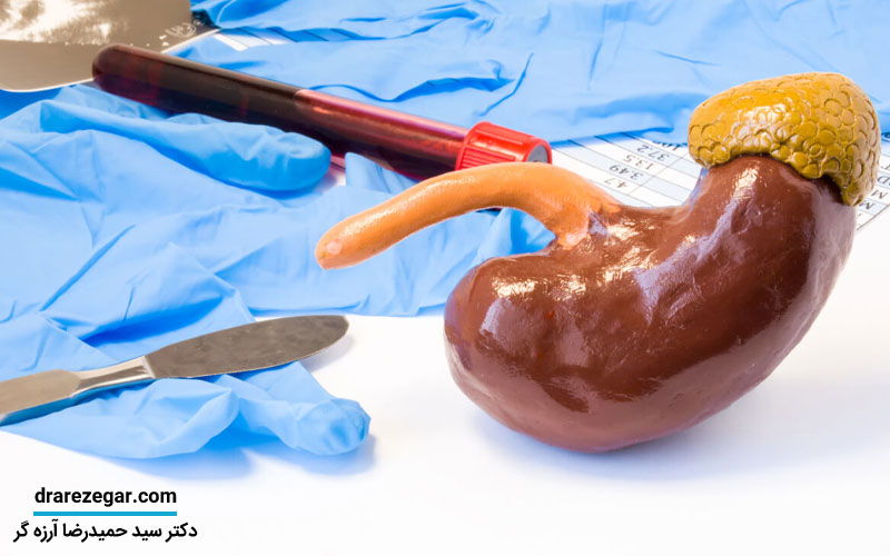 جراحی برداشتن کلیه