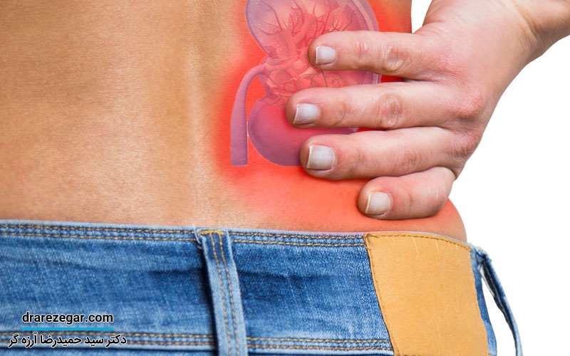 نشانه های عفونت کلیه