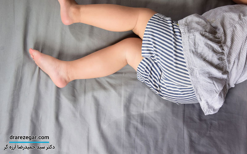 مهم ترین علل شب ادراری در کودکان