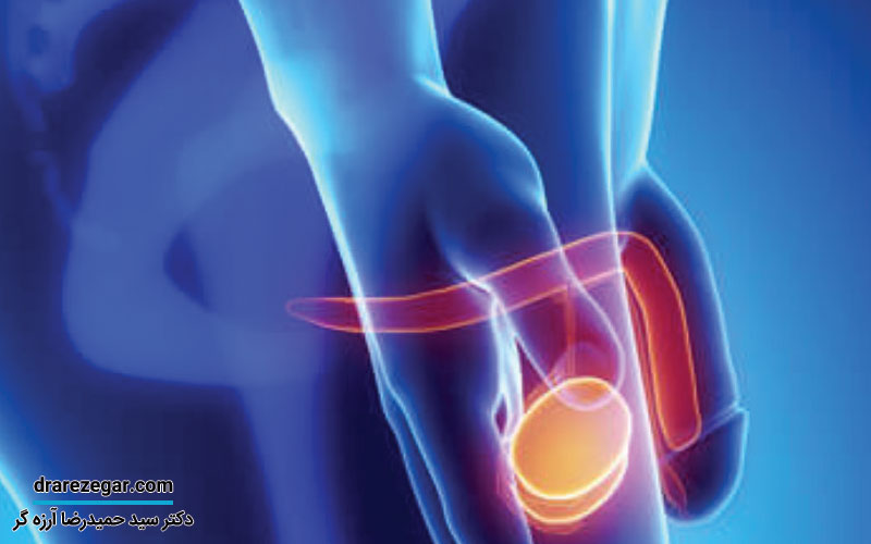 سرطان آلت تناسلی در مردان