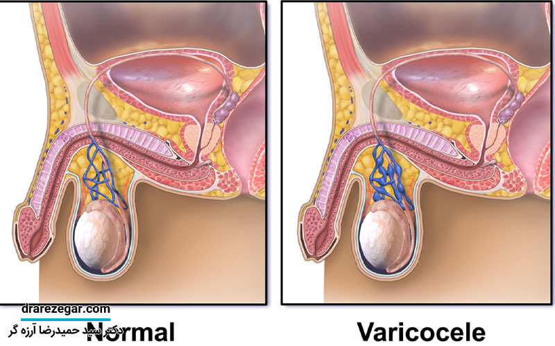 علائم آتروفی بیضه