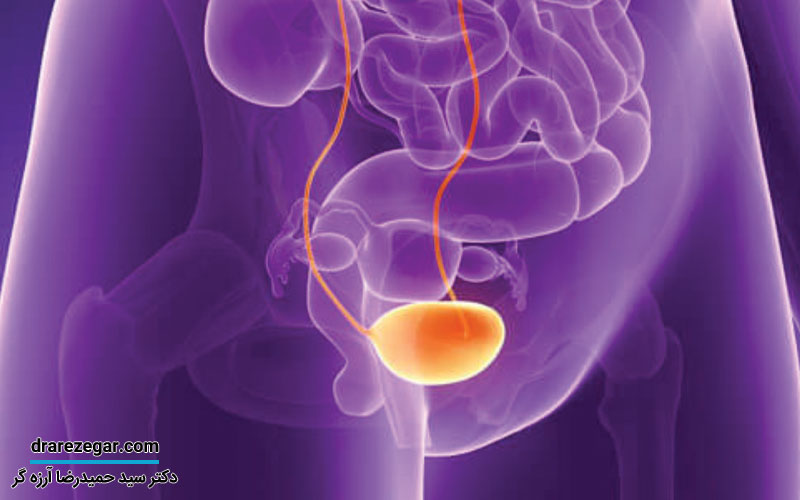 سندرم مثانه دردناک چیست