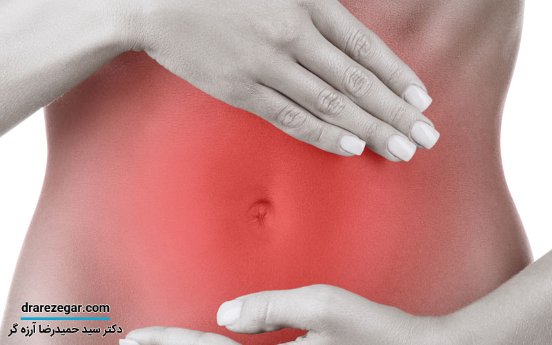 علت افتادگی مثانه چیست