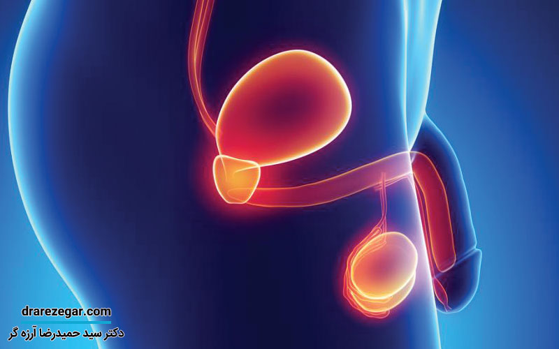 علل و علائم بیماری سرطان بیضه