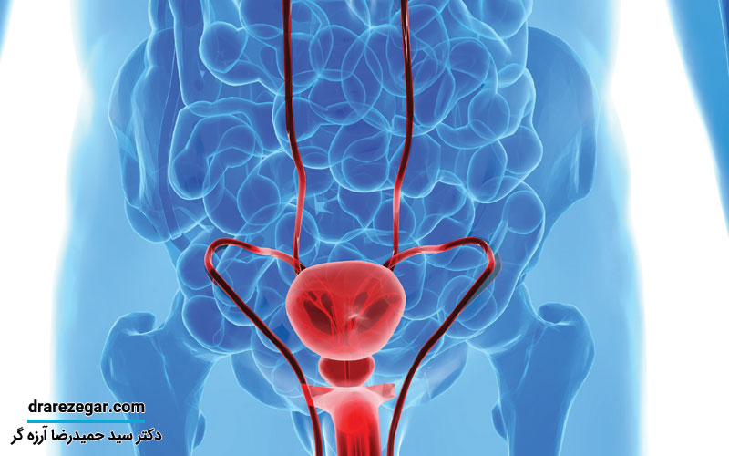 علل و علائم بیماری سرطان بیضه