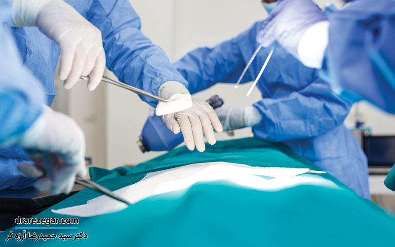 جراحی کیسه بیضه