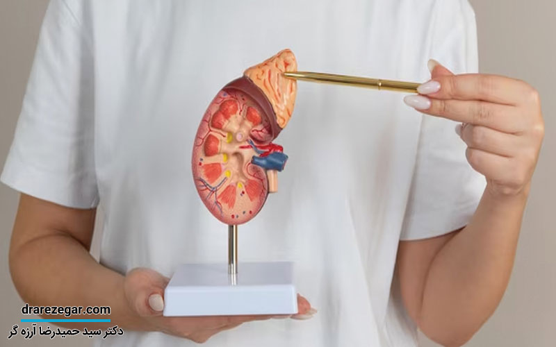 انواع تومورهای غدد فوق کلیوی