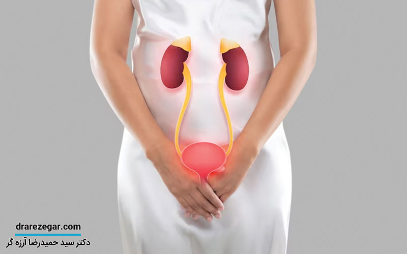 برگشت ادراری چیست