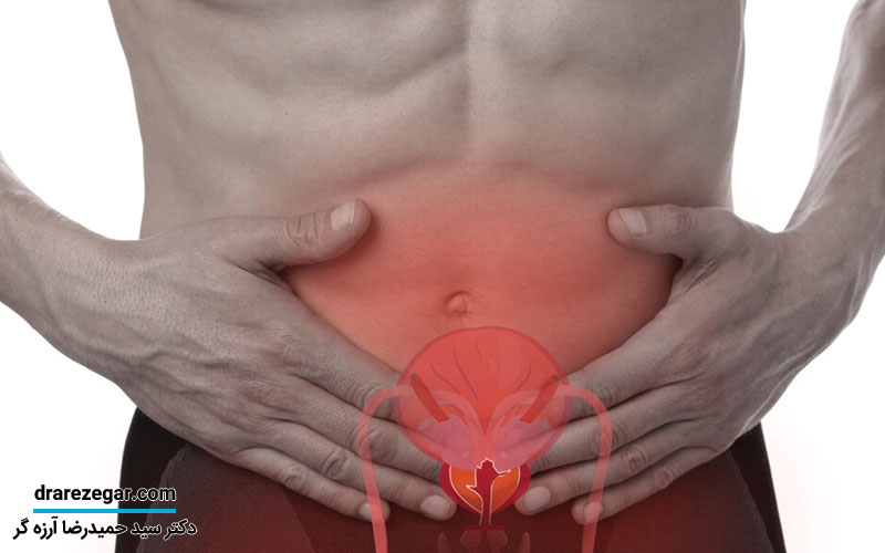 علائم تنگی مجرای ادرار در مردان