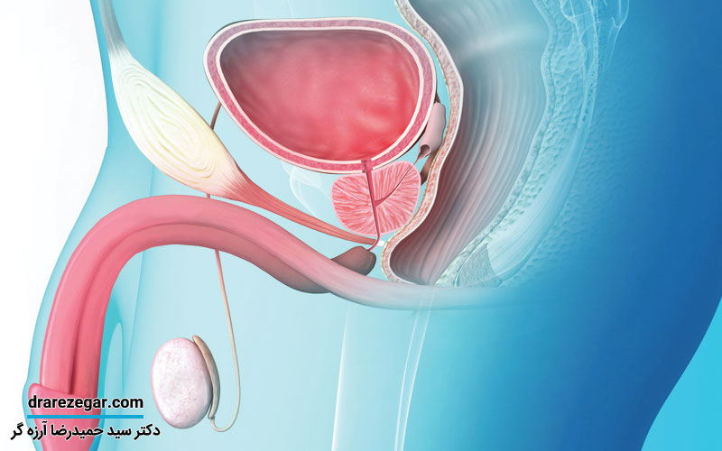 علائم تنگی مجرای ادرار در مردان