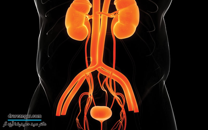 علائم التهاب مجرای ادراری