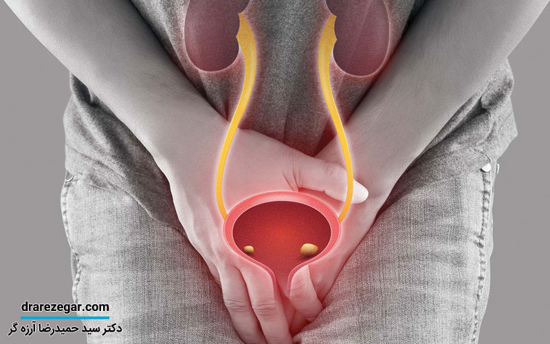 علائم التهاب مجرای ادراری