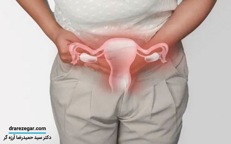 علائم التهاب مجرای ادراری