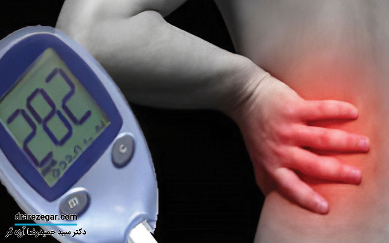 نفروپاتی دیابتی چیست