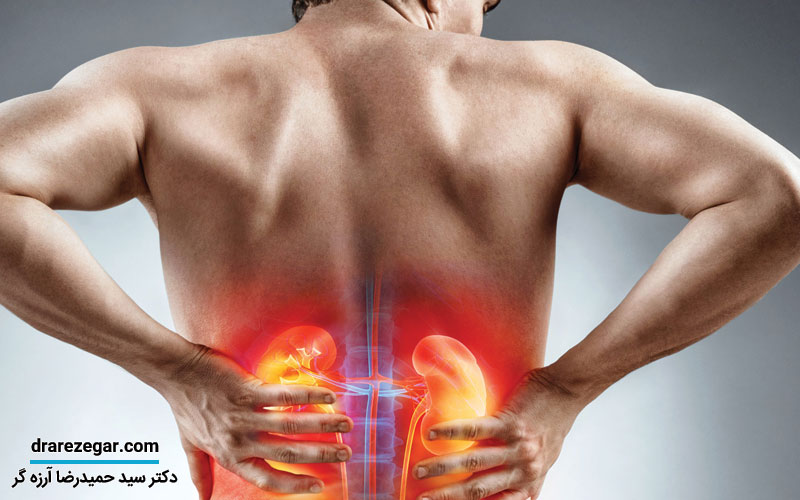 دلایل درد کلیه در صبحگاه