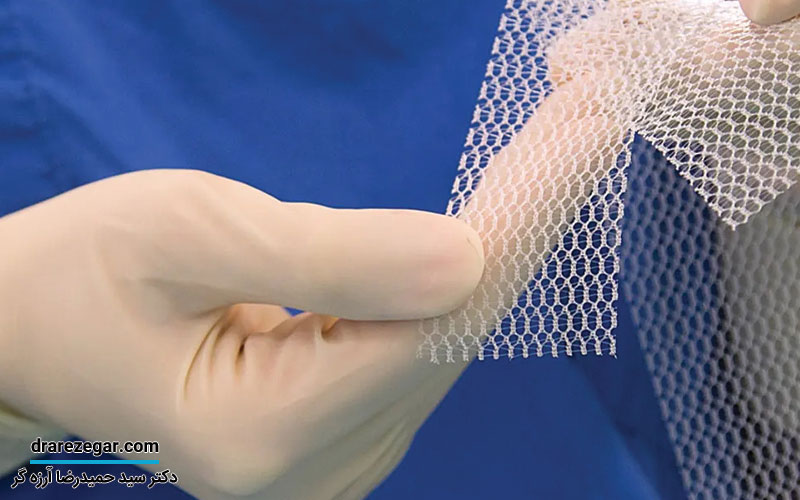 نوار مثانه چگونه انجام می شود