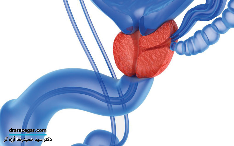 آیا بزرگی پروستات باعث ناتوانی جنسی می شود