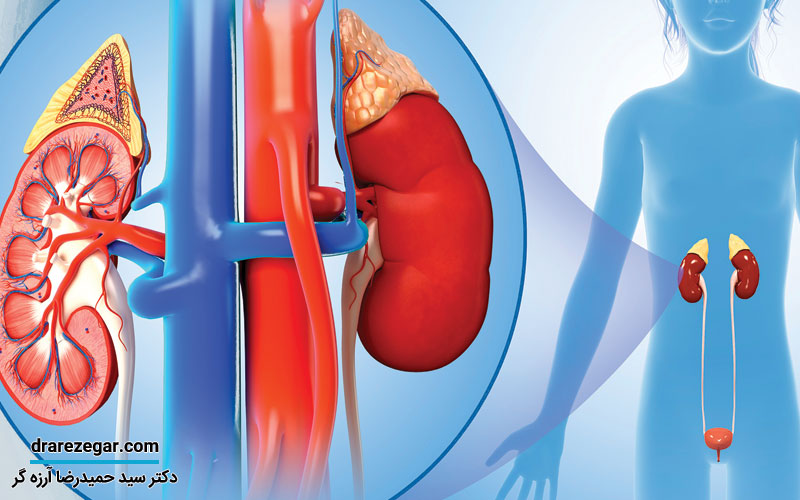 عمل پیلوپلاستی