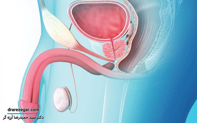 علل ایجاد تنگی مجرای ادرار