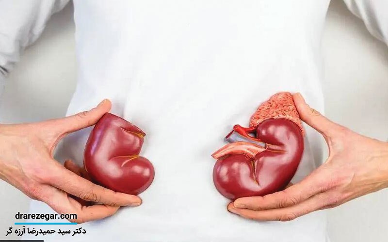 پیوند کلیه بهتر است یا دیالیز