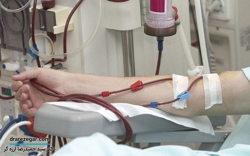 پیوند کلیه بهتر است یا دیالیز