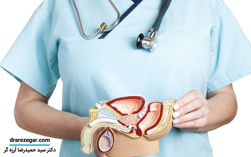 آیا تنها درمان واریکوسل جراحی است