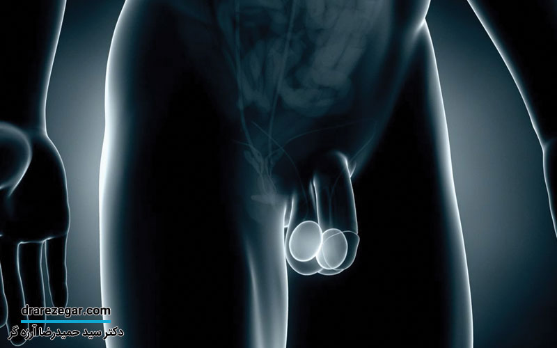 روش های تشخیص و درمان تومور بیضه