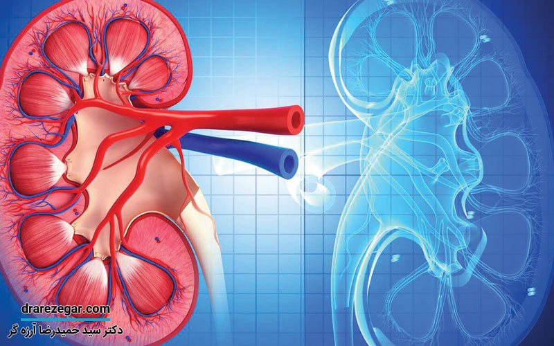 آیا نارسایی کلیه درمان قطعی دارد