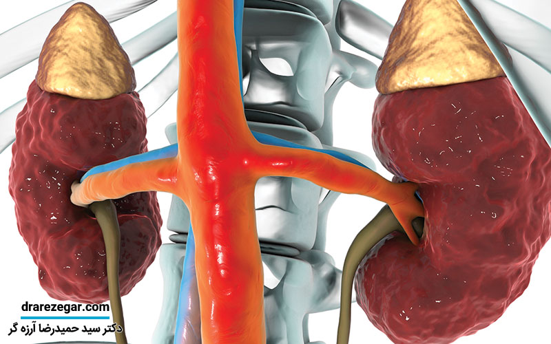 چگونه بفهمیم کلیه سالم داریم