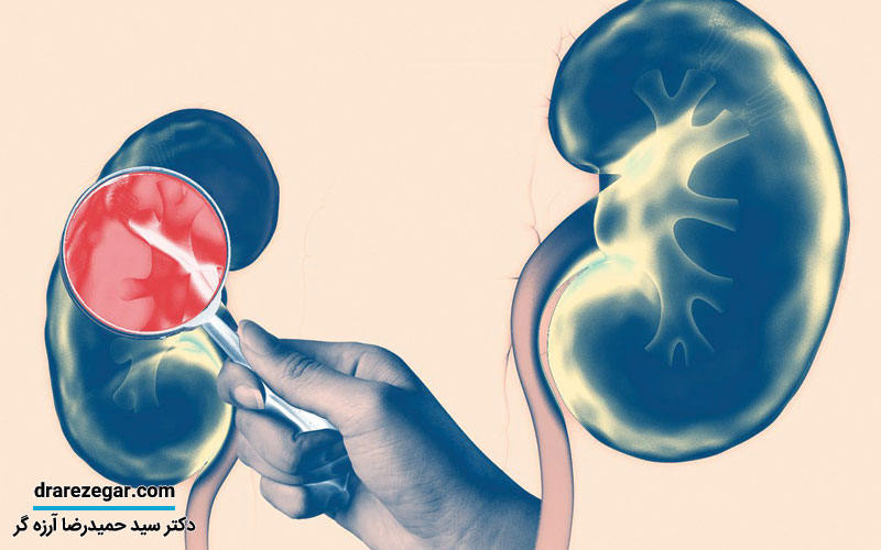 چگونه بفهمیم کلیه سالم داریم