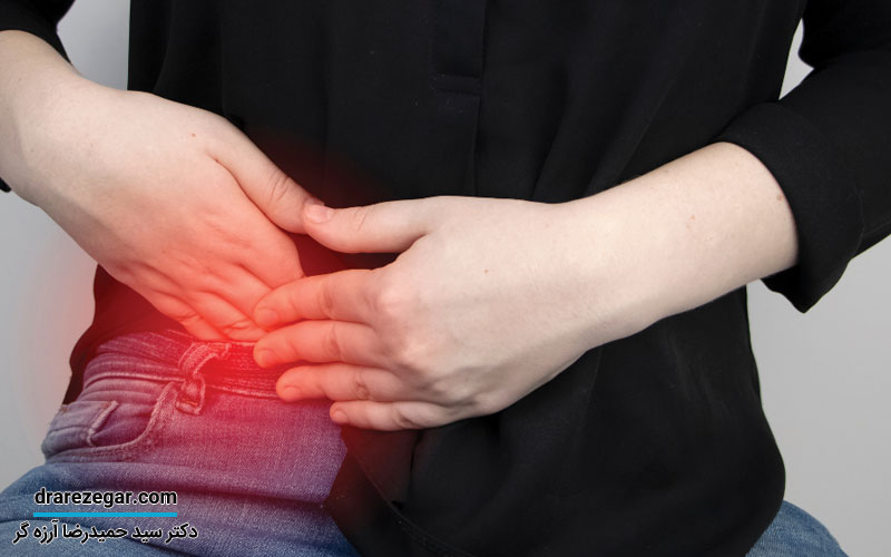 فرق آپاندیسیت با سنگ کلیه