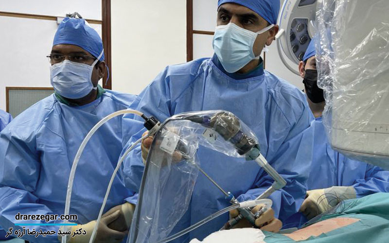 آنچه باید پیش از عملPCNL بدانید