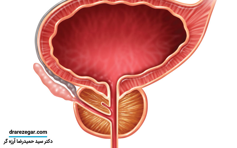 مواد غذایی مضر برای پروستات