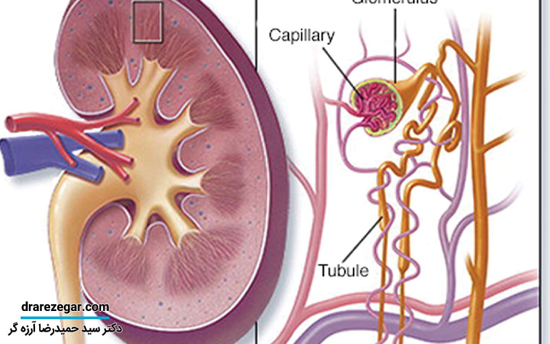 علائم دفع پروتئین در ادرار