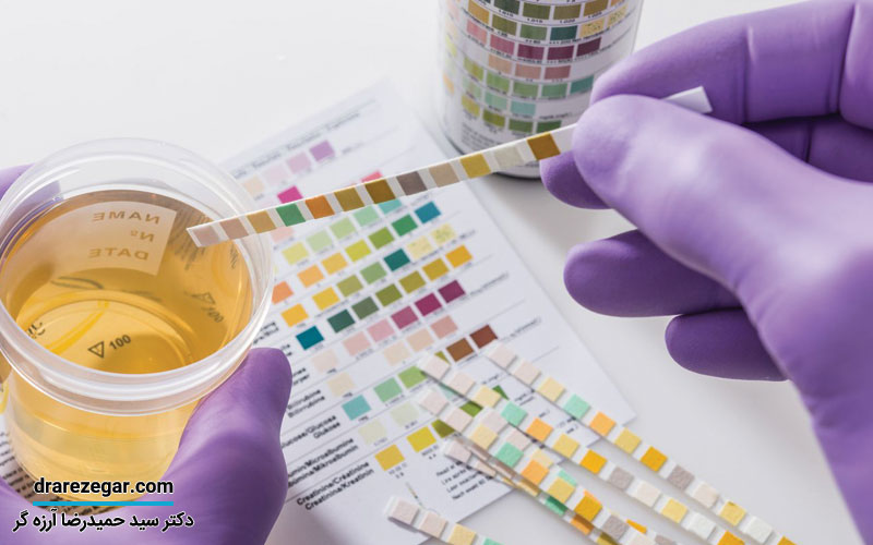 علائم دفع پروتئین در ادرار