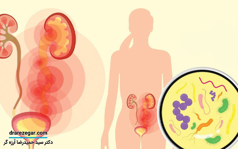 علائم بروز عفونت ادراری در کودکان و سالمندان