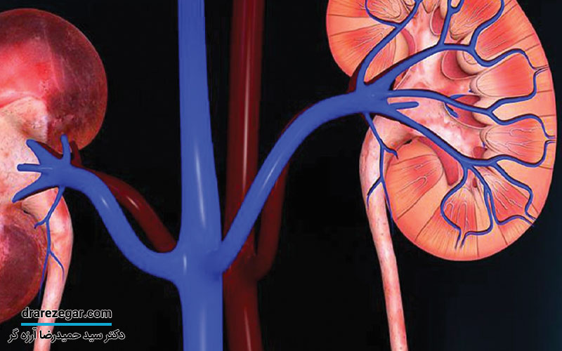 ازوتومی چیست