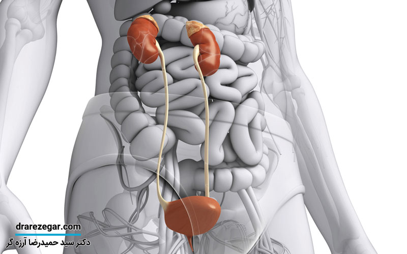 انواع اختلالات مثانه