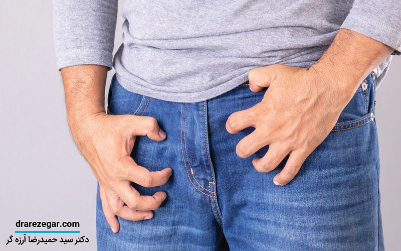 چگونه خارش بیضه را متوقف کنیم