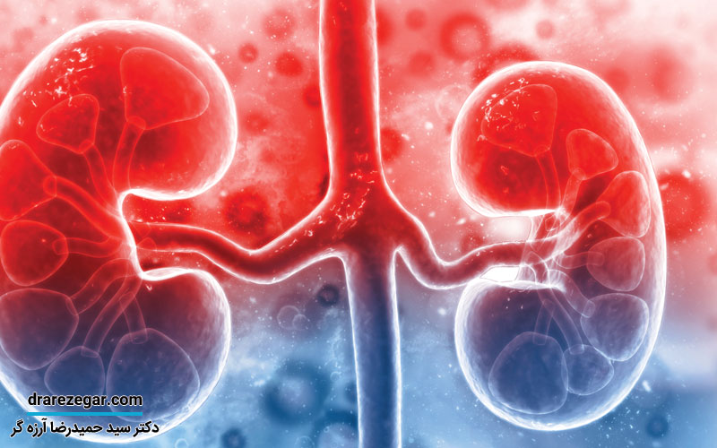 مشکلات کلیوی و ورم پا