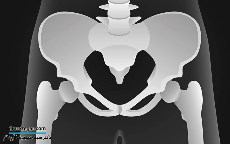 پیشگیری از افتادگی مثانه
