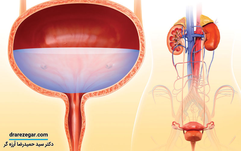 شش اقدام ساده در جهت حفظ سلامت مثانه