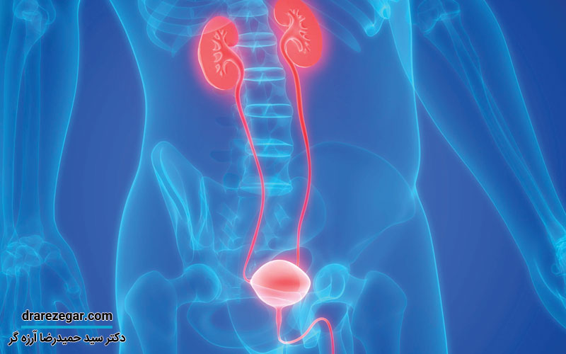 روش‌ های درمان سرطان حالب