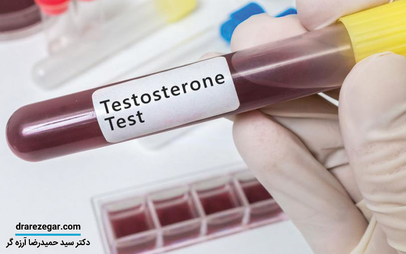 تستوسترون چیست