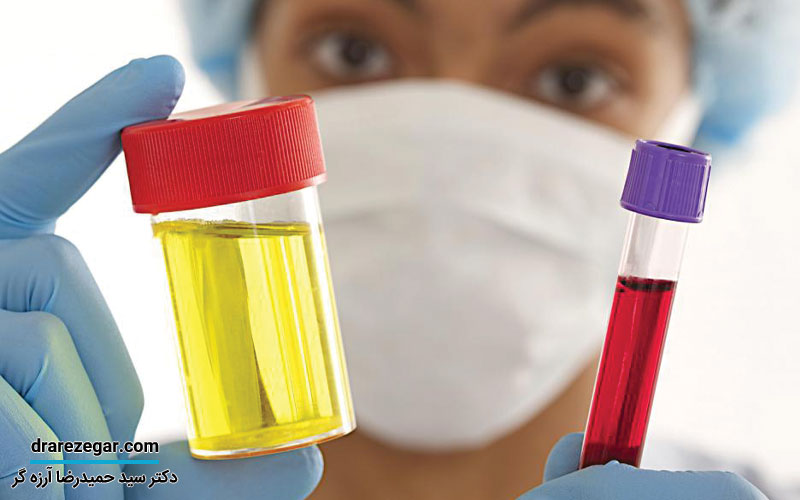 لخته خون در ادرار